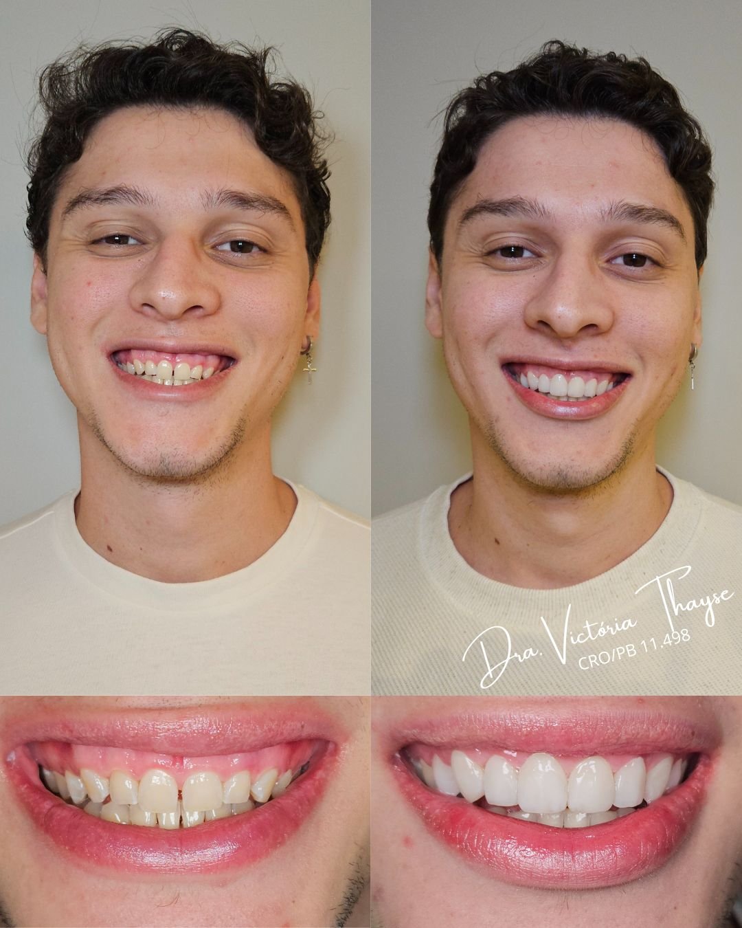 Formada aos 25 anos, realizo meu sonho transformando a saúde e a autoestima dos meus pacientes. - 6