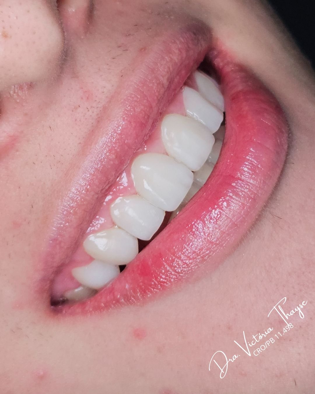 Formada aos 25 anos, realizo meu sonho transformando a saúde e a autoestima dos meus pacientes. - 7